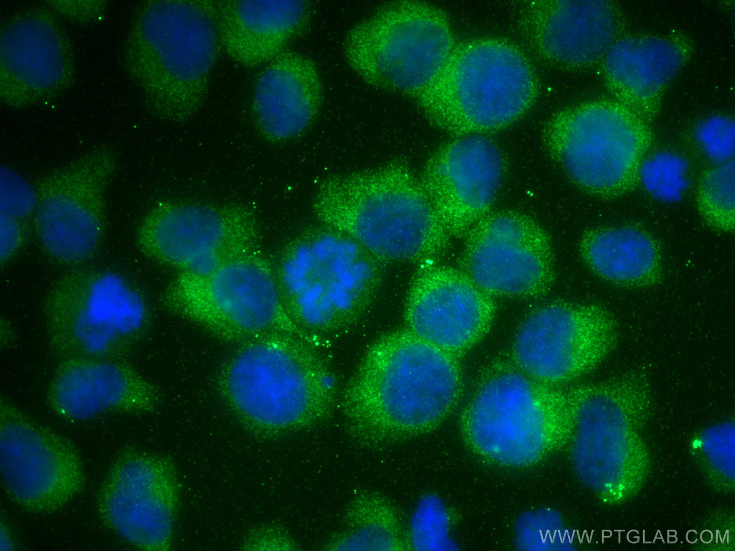 Immunofluorescence (IF) / fluorescent staining of Jurkat cells using DTD1 Polyclonal antibody (17480-1-AP)