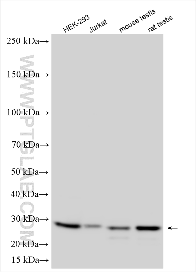 Western Blot (WB) analysis of various lysates using DTD1 Polyclonal antibody (17480-1-AP)