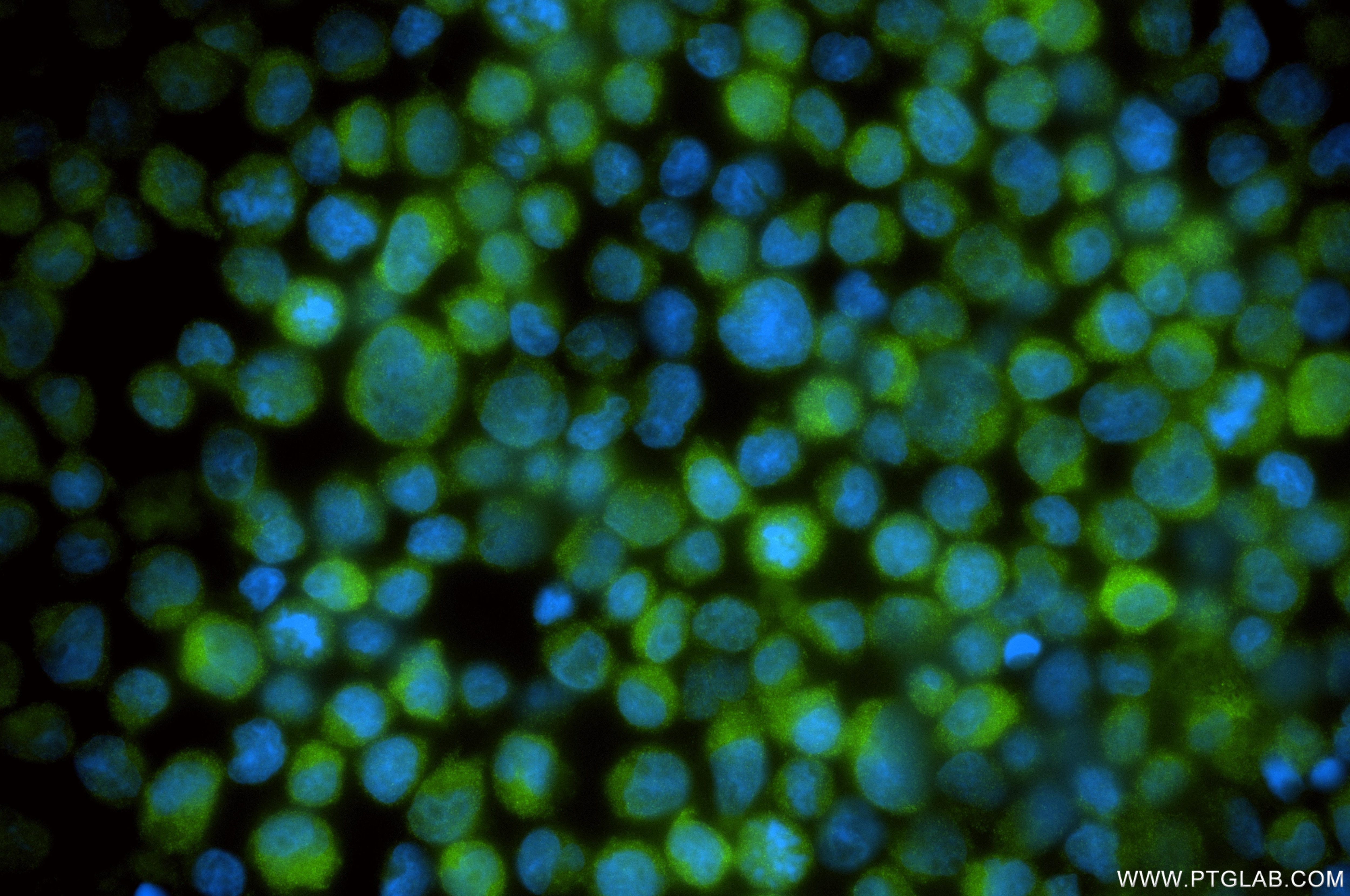 Immunofluorescence (IF) / fluorescent staining of Jurkat cells using DTD1 Recombinant monoclonal antibody (87297-1-RR)