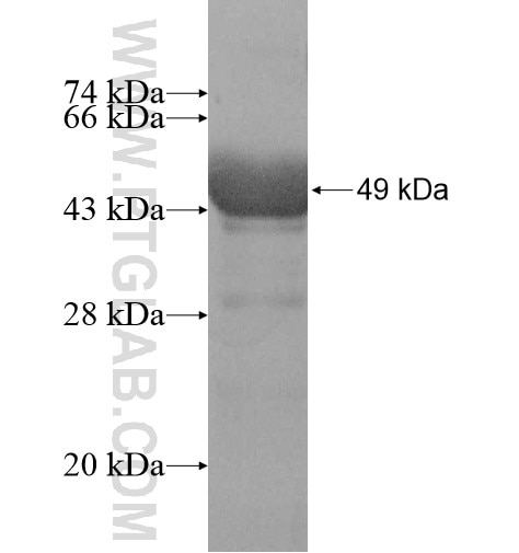DTD1 fusion protein Ag11510 SDS-PAGE