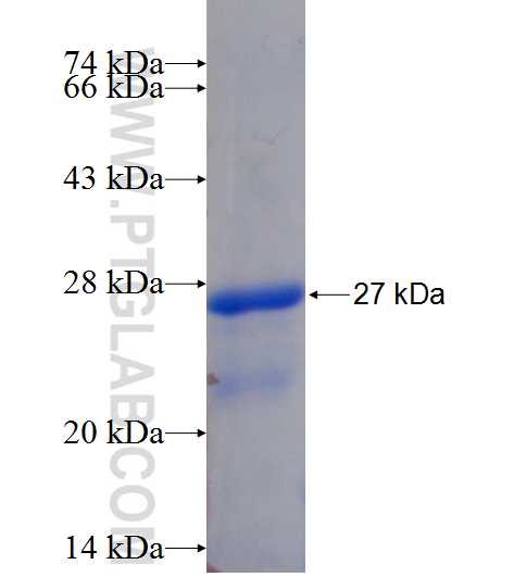 DTD1 fusion protein Ag11634 SDS-PAGE