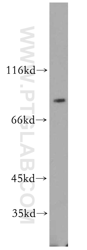 WB analysis of HeLa using 12896-1-AP