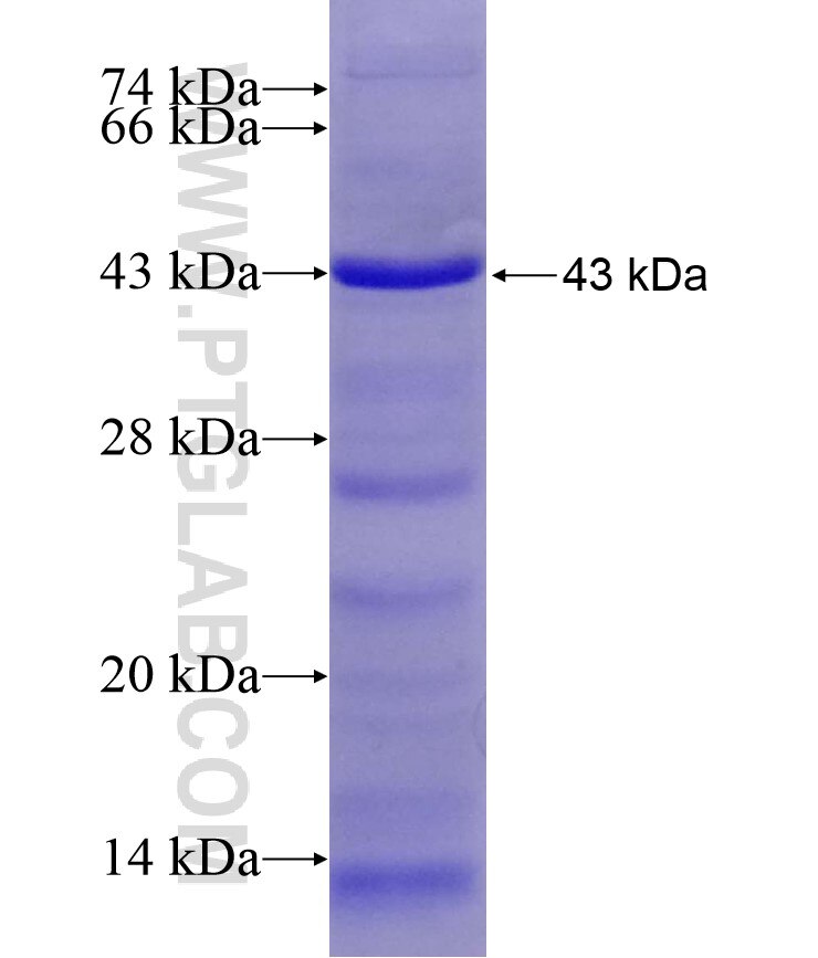 DTL fusion protein Ag17547 SDS-PAGE