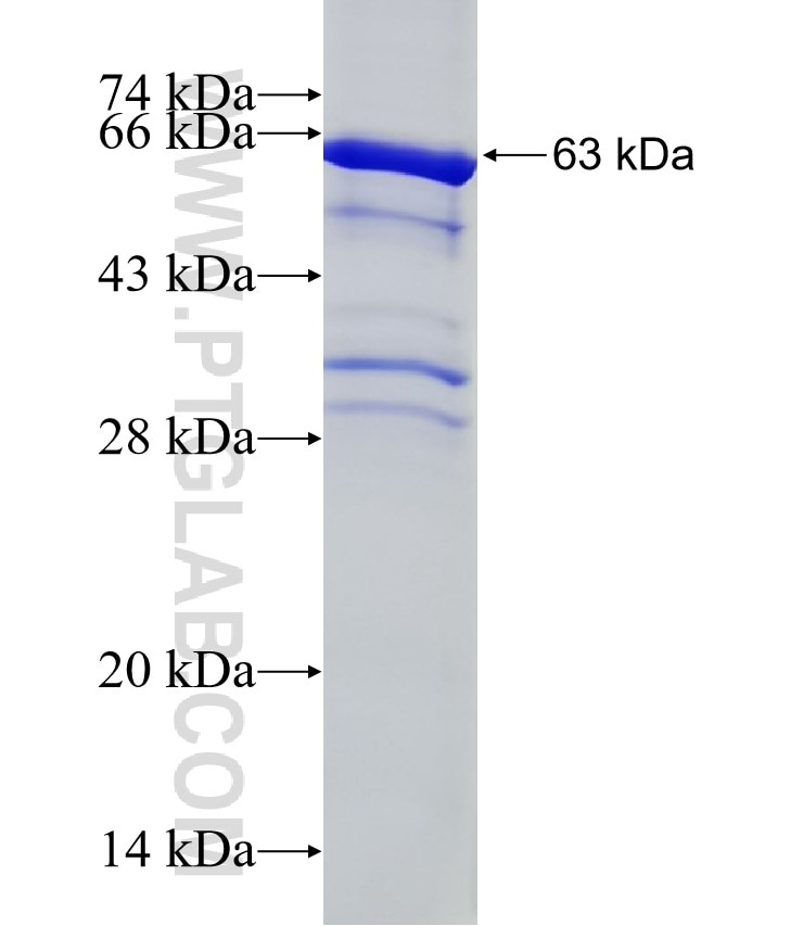 DTL fusion protein Ag3589 SDS-PAGE