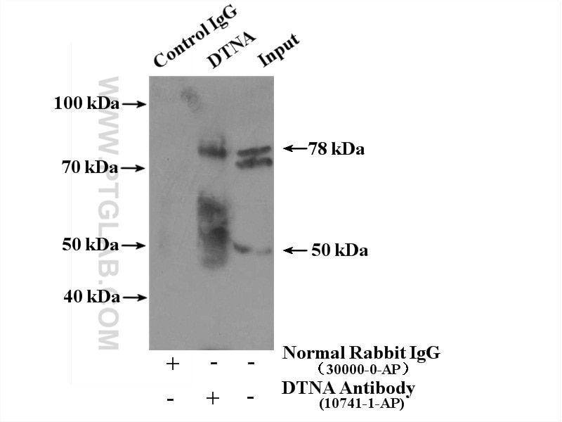 Immunoprecipitation (IP) experiment of mouse brain tissue using DTNA Polyclonal antibody (10741-1-AP)