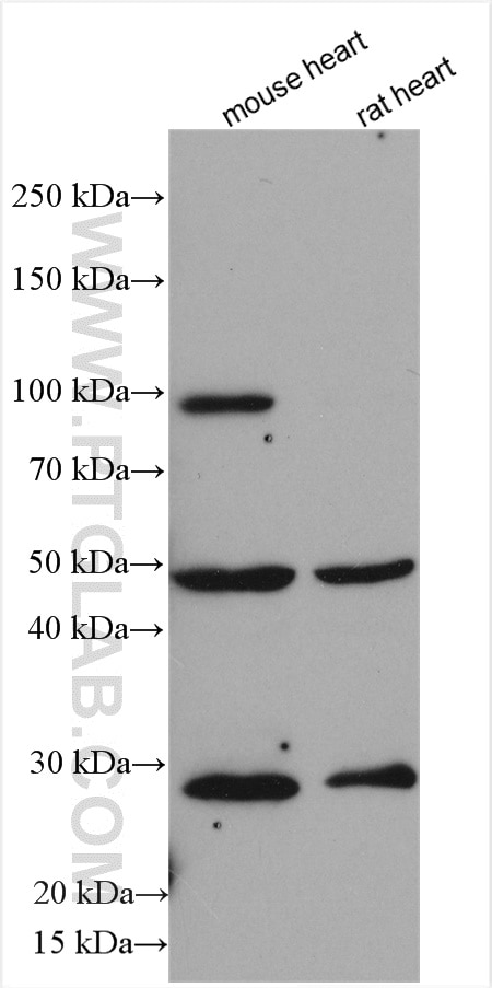 Western Blot (WB) analysis of various lysates using DTNA Polyclonal antibody (10741-1-AP)