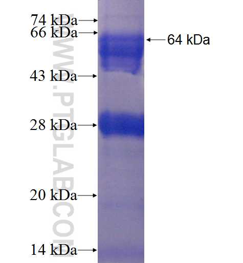 DTNA fusion protein Ag1075 SDS-PAGE