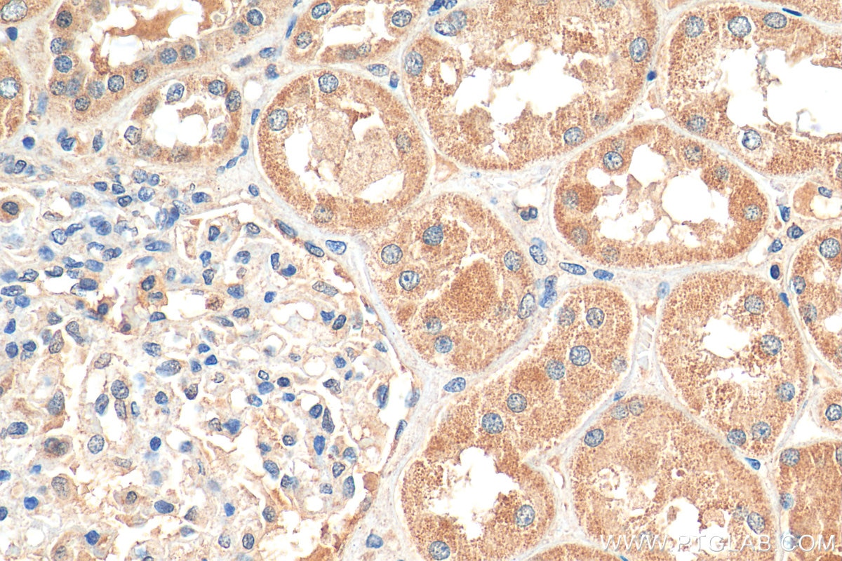 Immunohistochemistry (IHC) staining of human kidney tissue using DTNB Polyclonal antibody (12045-1-AP)