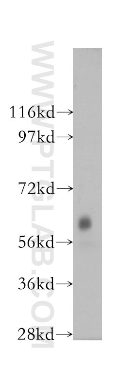 Western Blot (WB) analysis of mouse skeletal muscle tissue using DTNB Polyclonal antibody (12045-1-AP)