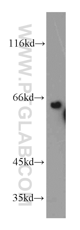 Western Blot (WB) analysis of mouse liver tissue using DTNB Polyclonal antibody (12045-1-AP)