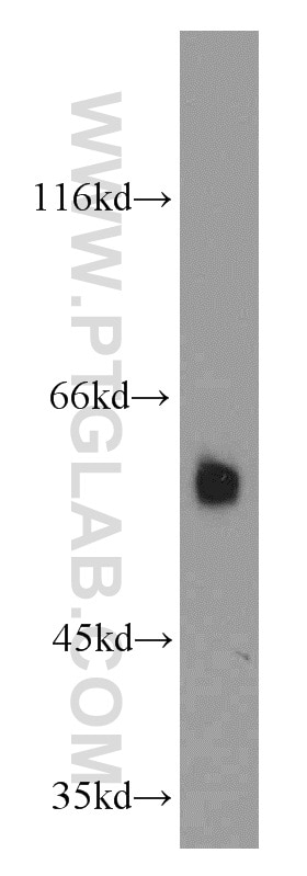 Western Blot (WB) analysis of NIH/3T3 cells using DTNB Polyclonal antibody (12045-1-AP)