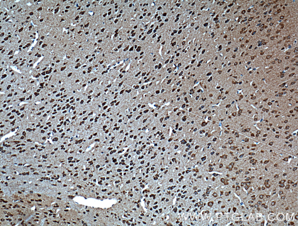 Immunohistochemistry (IHC) staining of mouse brain tissue using Dysbindin Polyclonal antibody (11132-1-AP)