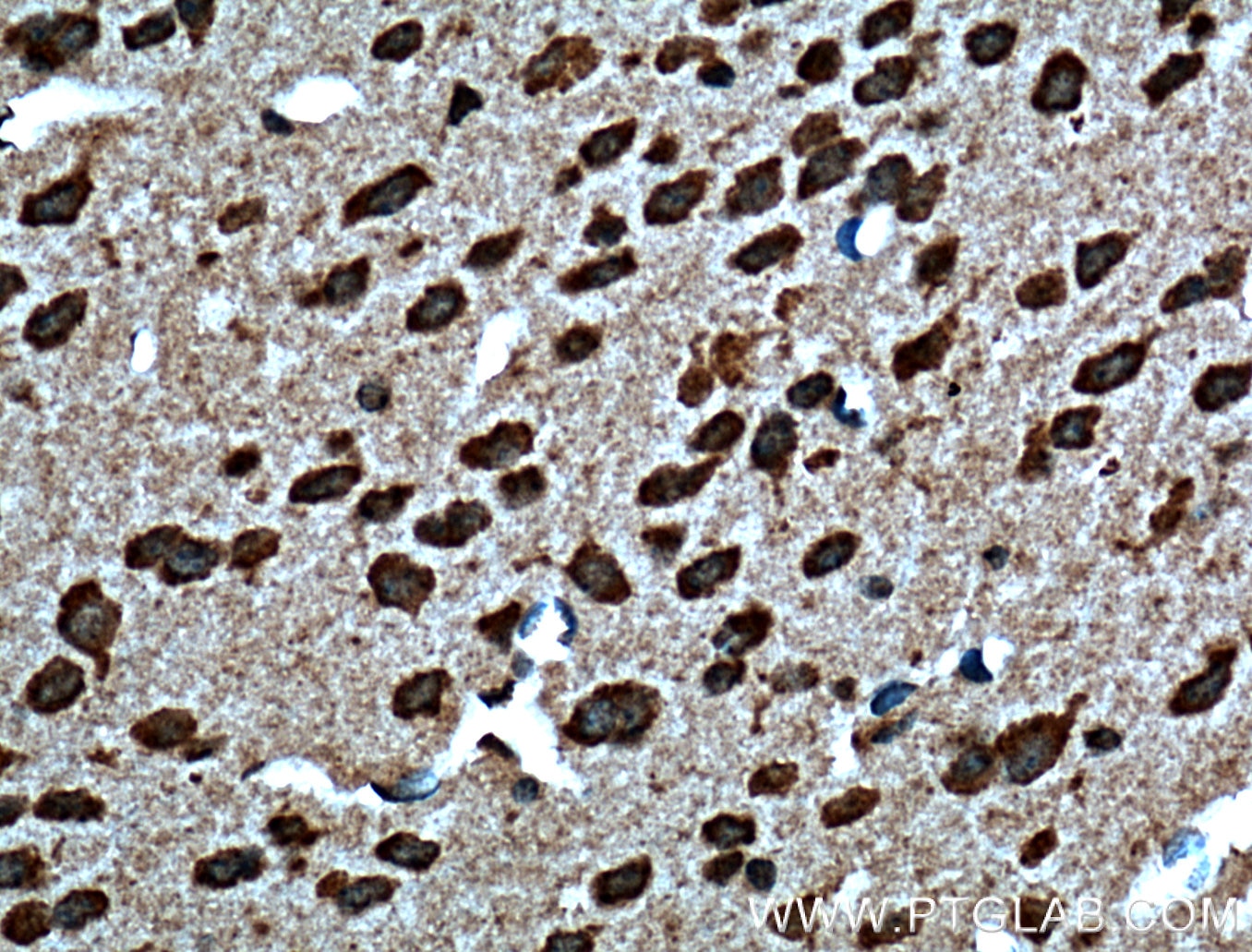 Immunohistochemistry (IHC) staining of mouse brain tissue using Dysbindin Polyclonal antibody (11132-1-AP)