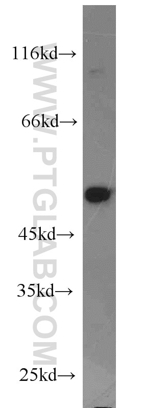 Western Blot (WB) analysis of human testis tissue using Dysbindin Polyclonal antibody (11132-1-AP)