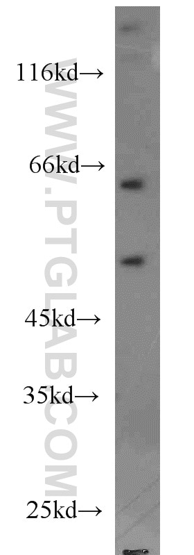 Dysbindin