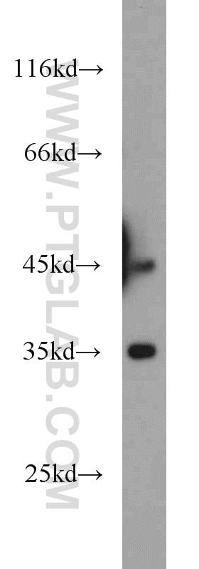 WB analysis of mouse brain using 11132-1-AP