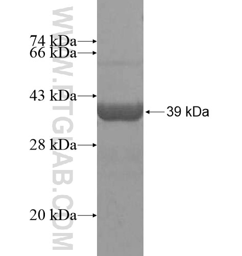DTNBP1a fusion protein Ag15943 SDS-PAGE