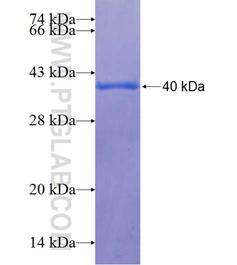 DTWD1 fusion protein Ag25170 SDS-PAGE