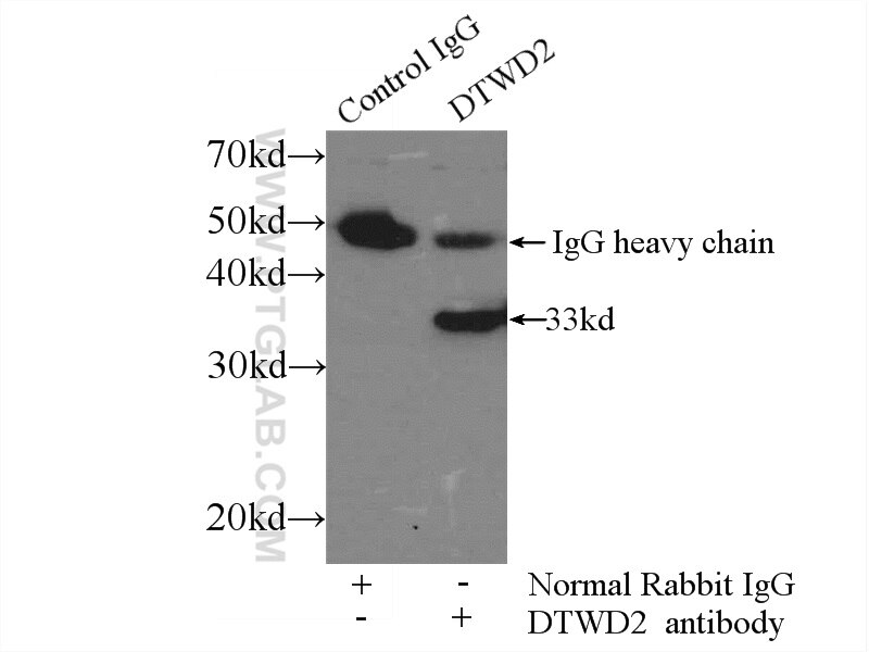 Immunoprecipitation (IP) experiment of COLO 320 cells using DTWD2 Polyclonal antibody (24873-1-AP)