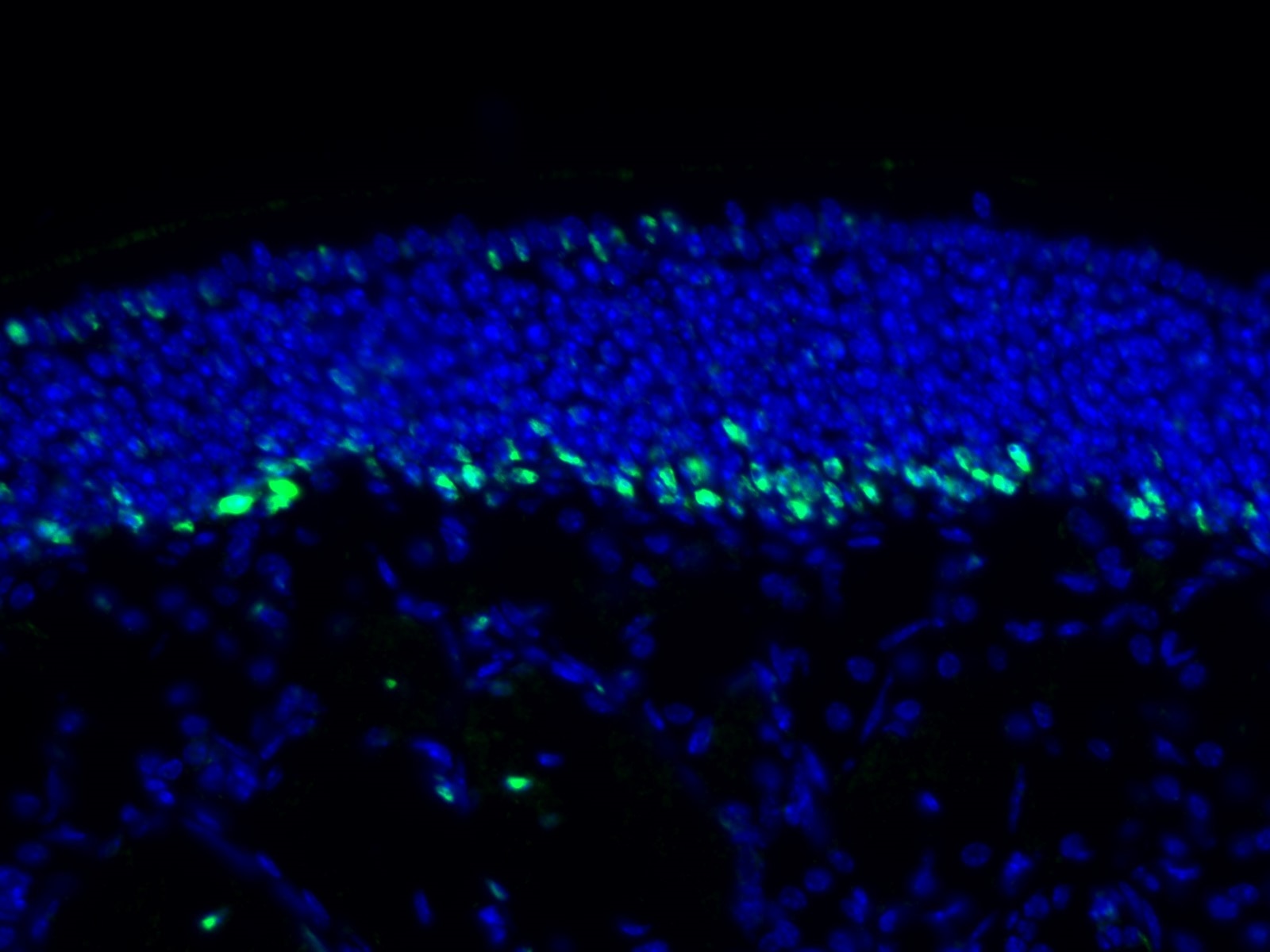 Immunofluorescence (IF) / fluorescent staining of mouse olfactory epithelium tissue using DTX1 Polyclonal antibody (18350-1-AP)