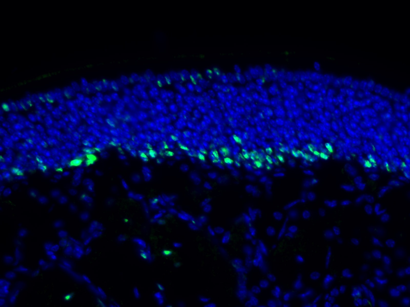 IF Staining of mouse olfactory epithelium tissue using 18350-1-AP