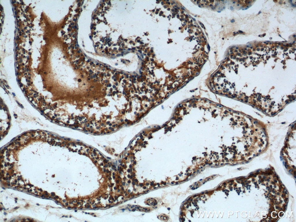 Immunohistochemistry (IHC) staining of human testis tissue using DTX1 Polyclonal antibody (18350-1-AP)