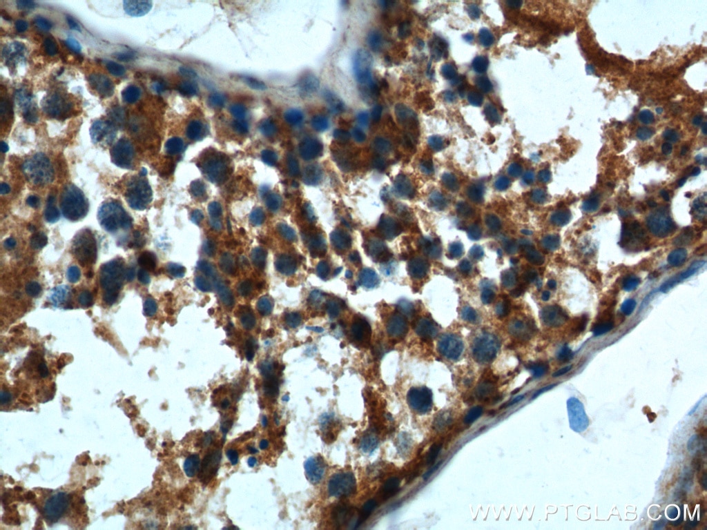 Immunohistochemistry (IHC) staining of human testis tissue using DTX1 Polyclonal antibody (18350-1-AP)