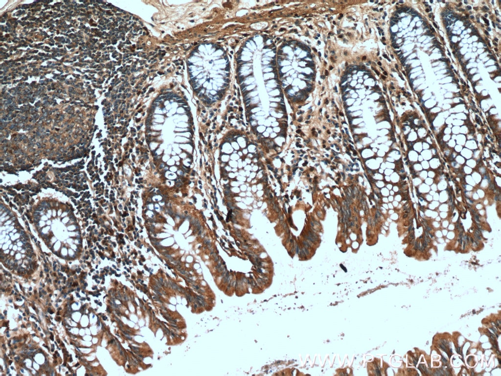 IHC staining of human colon using 18350-1-AP