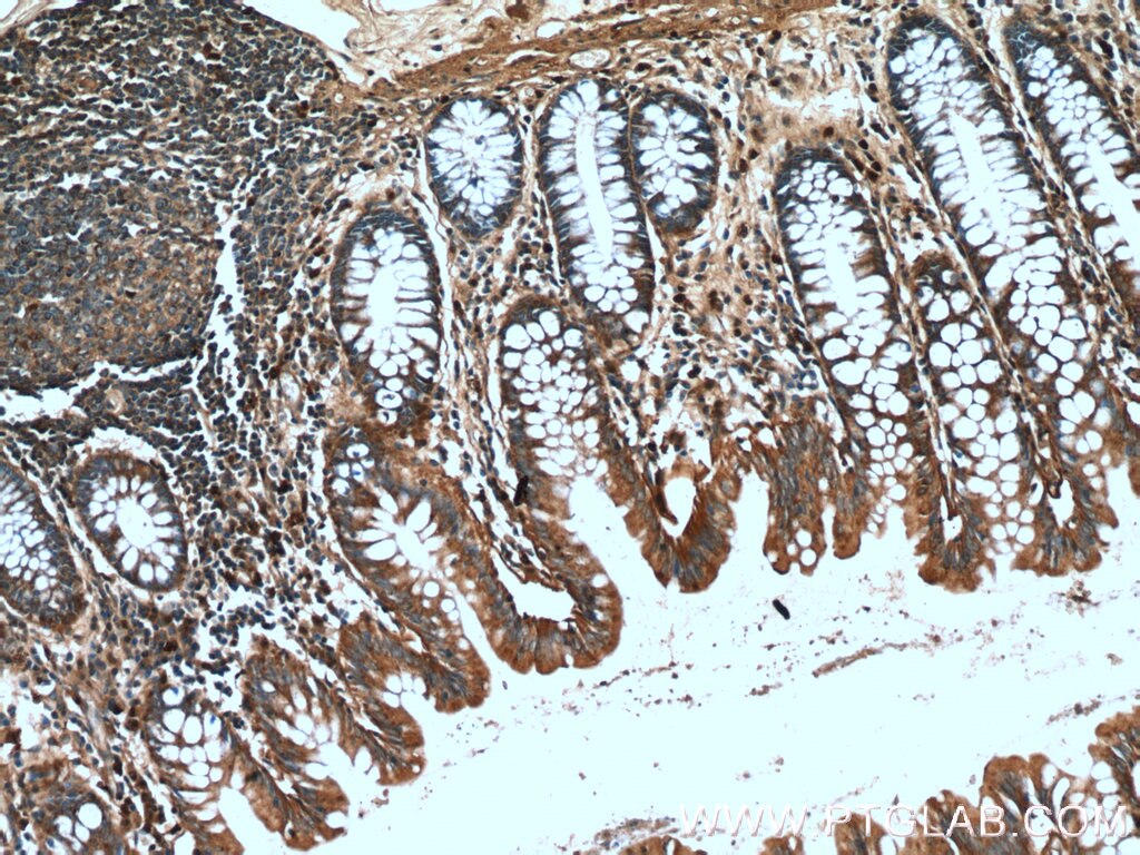 Immunohistochemistry (IHC) staining of human colon tissue using DTX1 Polyclonal antibody (18350-1-AP)