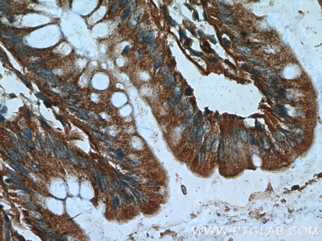 Immunohistochemistry (IHC) staining of human colon tissue using DTX1 Polyclonal antibody (18350-1-AP)