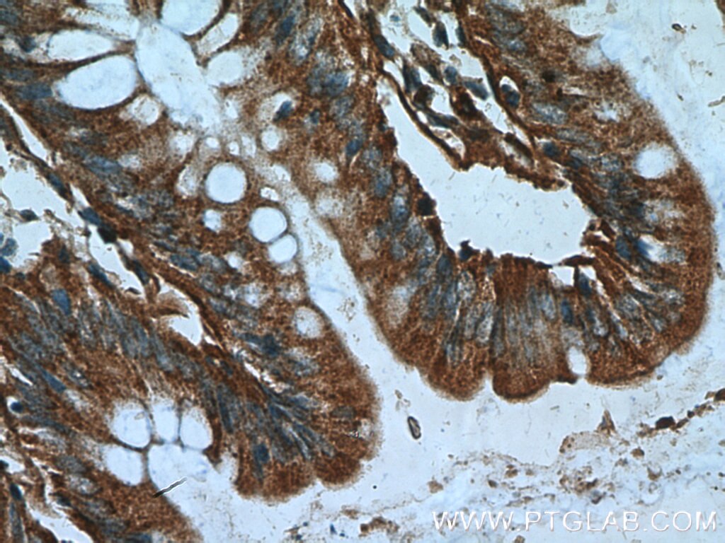 IHC staining of human colon using 18350-1-AP