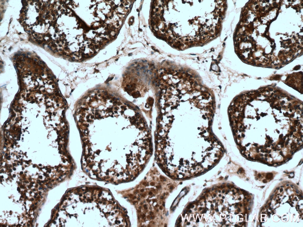 Immunohistochemistry (IHC) staining of human testis tissue using DTX1 Polyclonal antibody (18350-1-AP)
