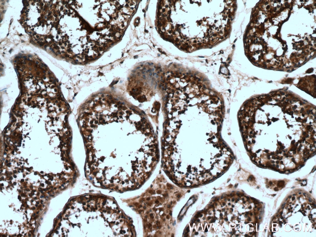 IHC staining of human testis using 18350-1-AP