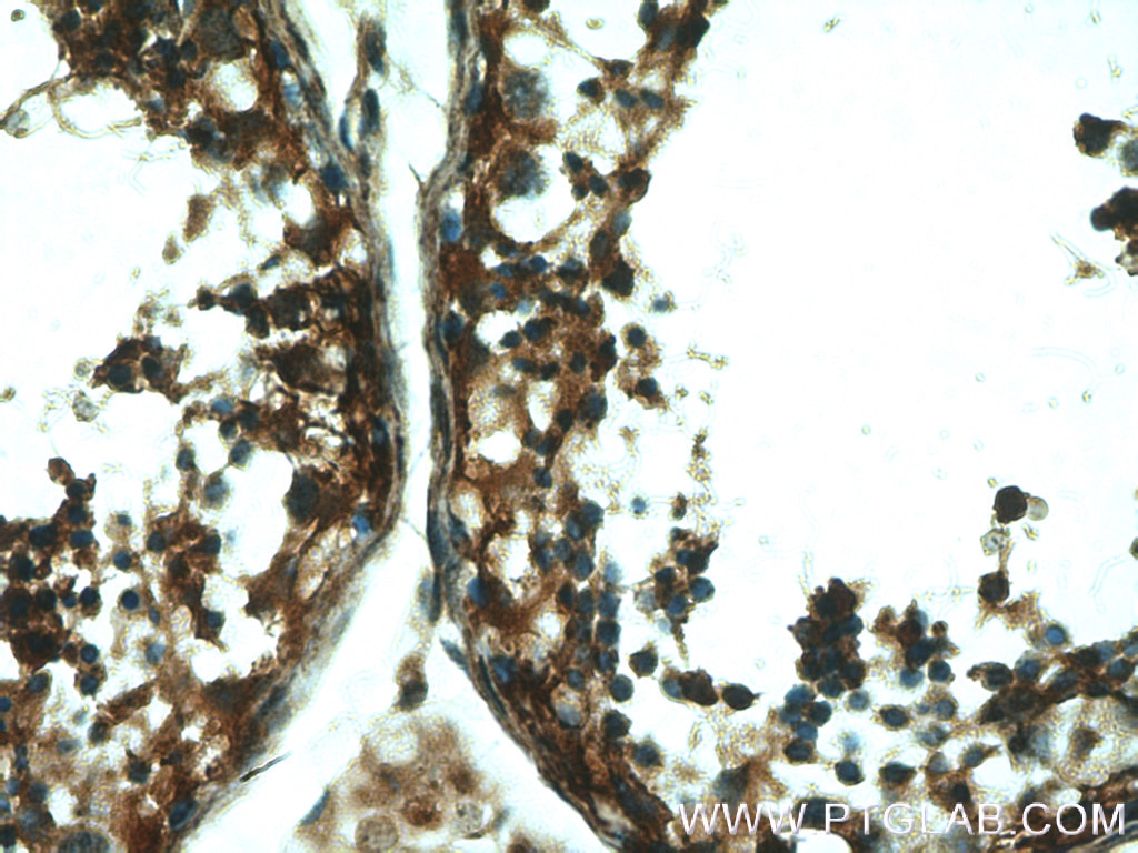 Immunohistochemistry (IHC) staining of human testis tissue using DTX1 Polyclonal antibody (18350-1-AP)