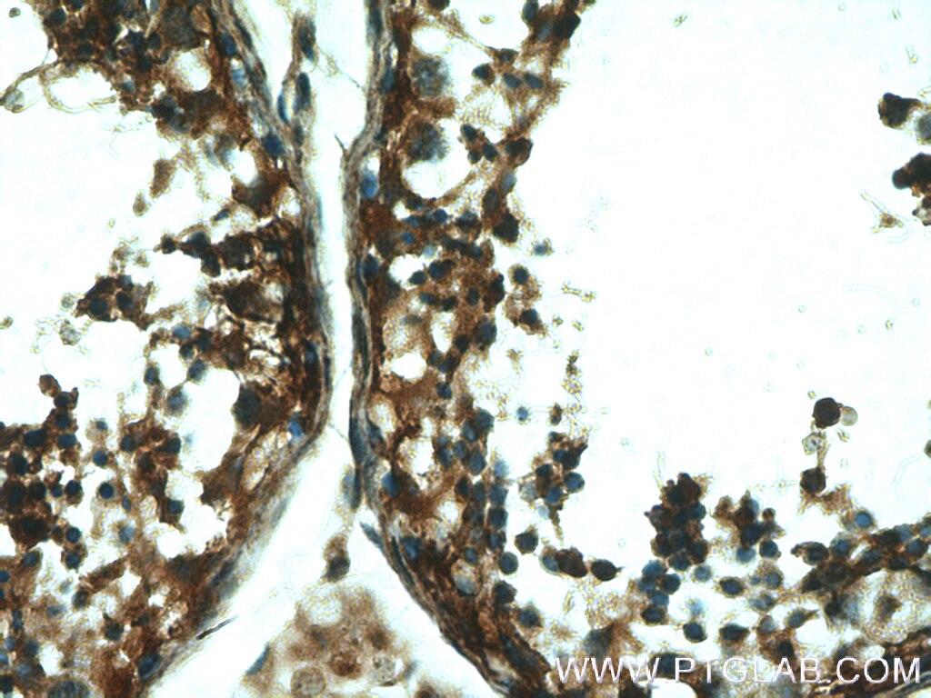 IHC staining of human testis using 18350-1-AP