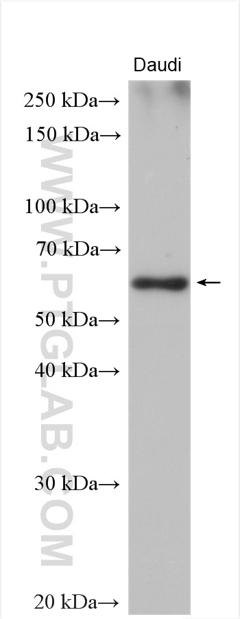 Western Blot (WB) analysis of Daudi cells using DTX1 Polyclonal antibody (18350-1-AP)