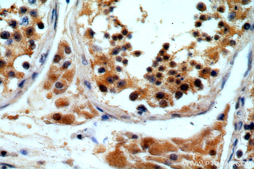 Immunohistochemistry (IHC) staining of human testis tissue using DTX2 Polyclonal antibody (18565-1-AP)