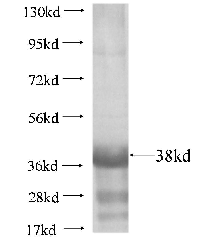 DTX2 fusion protein Ag4376 SDS-PAGE