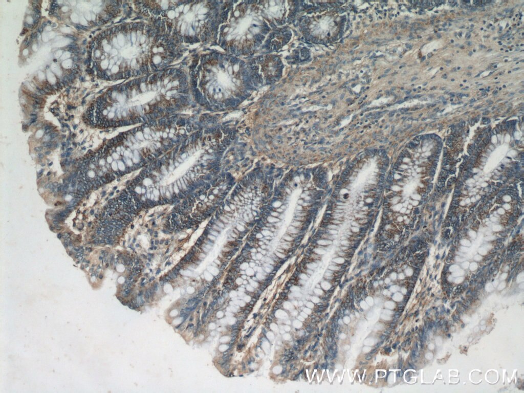 Immunohistochemistry (IHC) staining of human colon tissue using DTX3 Polyclonal antibody (25304-1-AP)