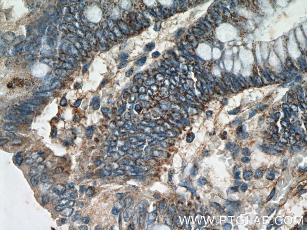 Immunohistochemistry (IHC) staining of human colon tissue using DTX3 Polyclonal antibody (25304-1-AP)