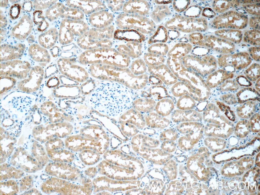 IHC staining of human kidney using 25304-1-AP