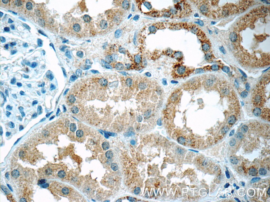 Immunohistochemistry (IHC) staining of human kidney tissue using DTX3 Polyclonal antibody (25304-1-AP)