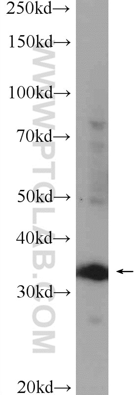 Western Blot (WB) analysis of mouse kidney tissue using DTX3 Polyclonal antibody (25304-1-AP)
