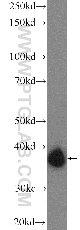 WB analysis of mouse testis using 25304-1-AP