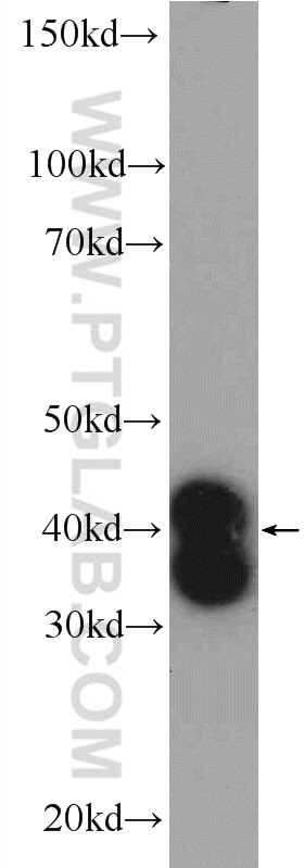 Western Blot (WB) analysis of mouse brain tissue using DTX3 Polyclonal antibody (25304-1-AP)