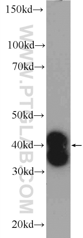 WB analysis of mouse brain using 25304-1-AP