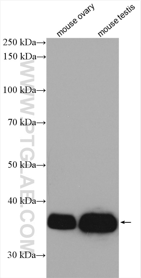 Western Blot (WB) analysis of various lysates using DTX3 Polyclonal antibody (25304-1-AP)