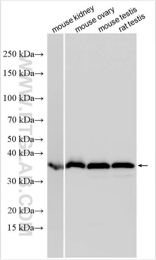Western Blot (WB) analysis of various lysates using DTX3 Polyclonal antibody (25304-1-AP)