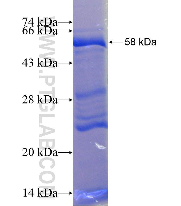DTX3 fusion protein Ag18111 SDS-PAGE
