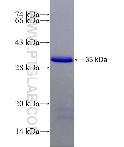 DTX3 fusion protein Ag18156 SDS-PAGE